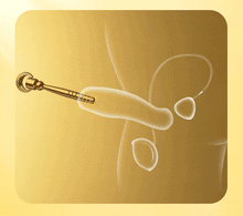 Load image into Gallery viewer, Urethral Plug 3pcs β animated product feature demonstration, gallery view 3